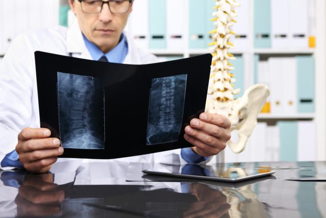 Radiologist doctor checking back xray