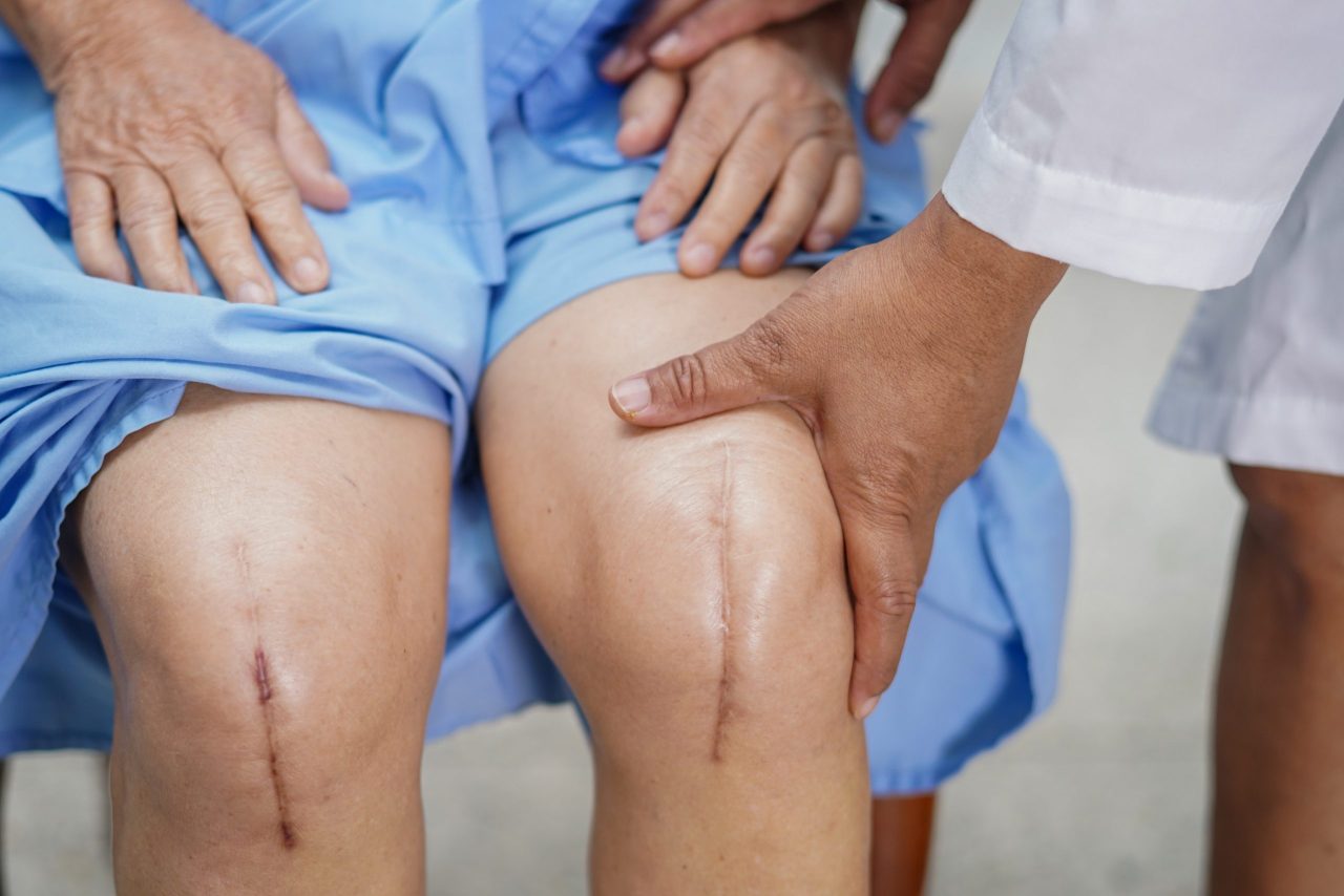 How We Recommend Preparing For Joint Replacement Surgery